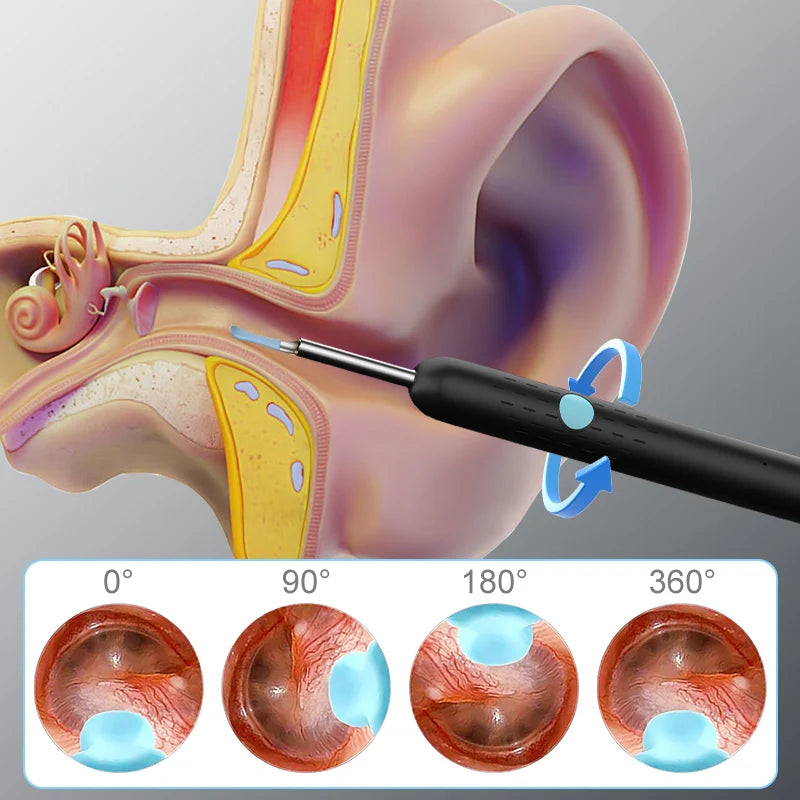 Ear Cleaner Camera 4.2mm HD1080P Digital Ear Cleaning Endoscope WiFi Visual Ear Pick Video Ear Spoon 6LEDs Ear Wax Removal Tool